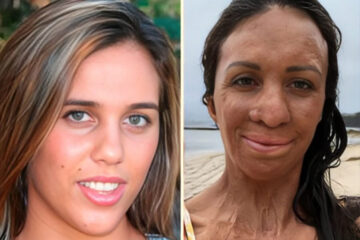 La mujer que renació del fuego: la historia de una sobreviviente convertida en símbolo de resiliencia