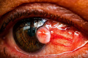 Especialistas advierten que los ojos pueden revelar enfermedades antes de que aparezcan síntomas