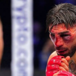 Topuria Recibe El Alta Tras UFC Freedom 250; No Requerirá Cirugía
