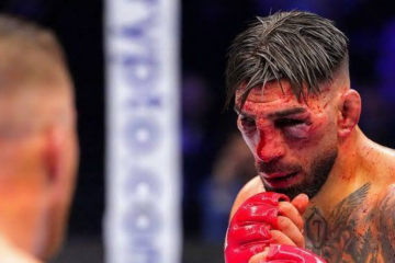 Topuria Recibe El Alta Tras UFC Freedom 250; No Requerirá Cirugía